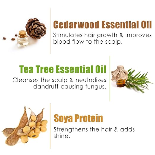 WOW Skin Science Anti-Dandruff Shampoo – Clear Scalp, Confident You